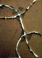 img/Lacerazioni/LineTime 3.jpg